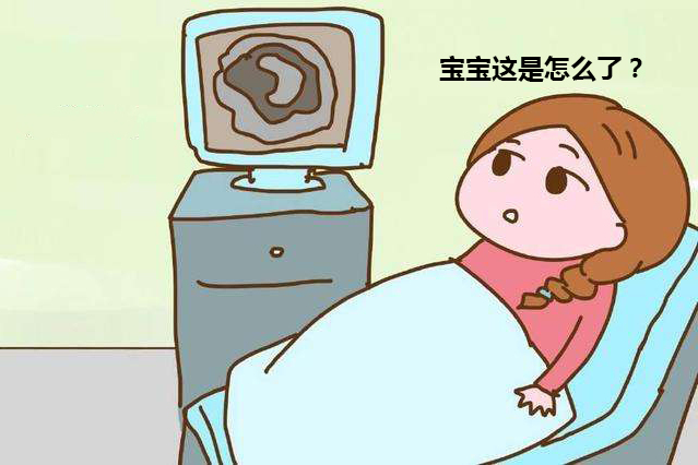 孕4个月头晕,孕四个月头晕，原因、应对与管理