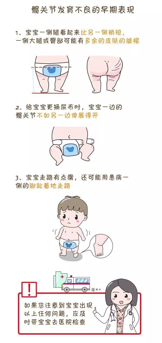 6个月宝宝臀纹不对称,关于六个月宝宝臀纹不对称的探讨