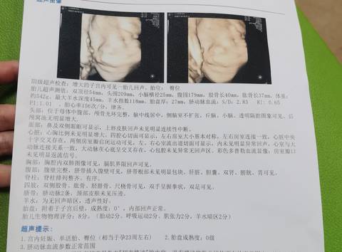 六个月四维彩超单子,六个月四维彩超单子，解读孕期重要检查