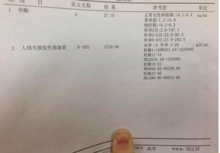 一个月会不会排卵两次,一个月会不会排卵两次？探究女性生理周期的奥秘